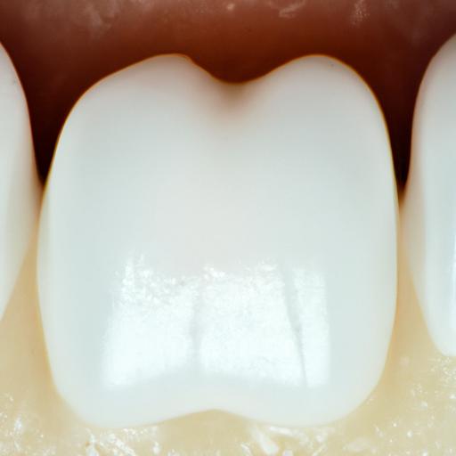Exposed dentin, a common cause of tooth sensitivity