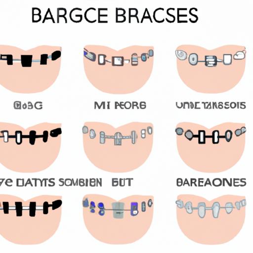 Different types of braces: metal, ceramic, and lingual braces.