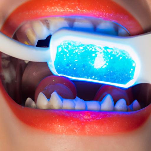 Achieve a brighter smile with Zoom teeth whitening gel and LED light treatment.